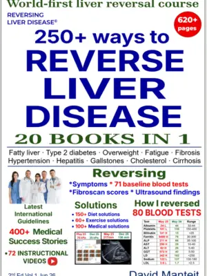 250+ Ways to Reverse Liver Disease - ebook